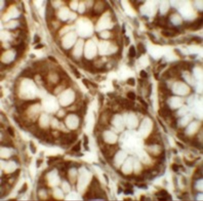 LRRFIP2 Antibody in Immunohistochemistry (IHC)