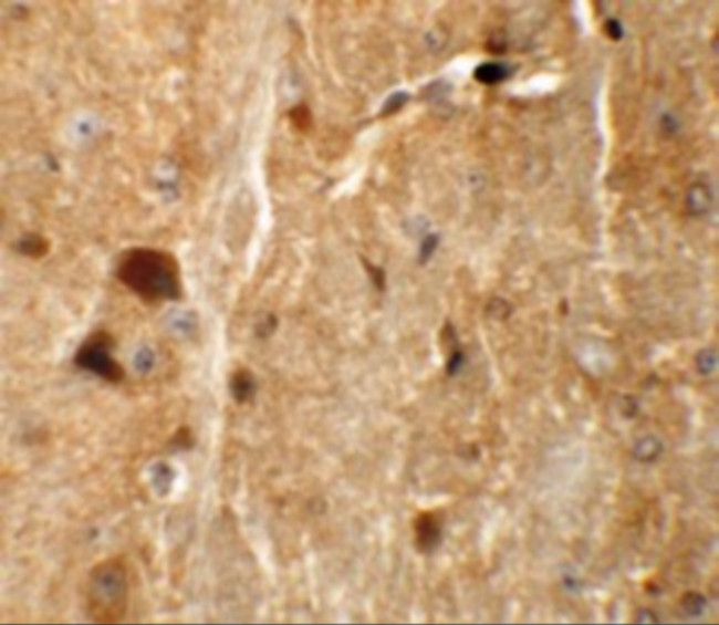 TMEM192 Antibody in Immunohistochemistry (IHC)