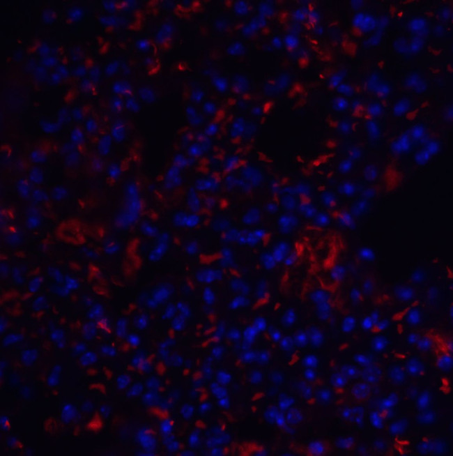 TM4SF1 Antibody in Immunohistochemistry (IHC)
