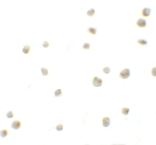 DYRK2 Antibody in Immunocytochemistry (ICC/IF)