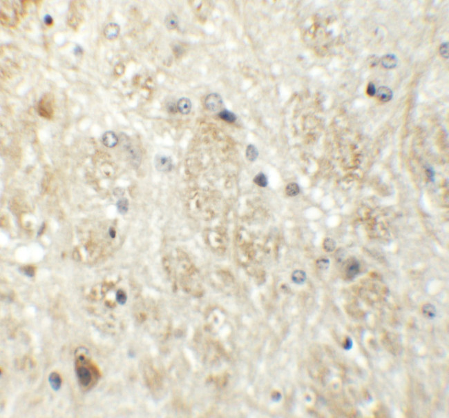 PRR5 Antibody in Immunohistochemistry (IHC)