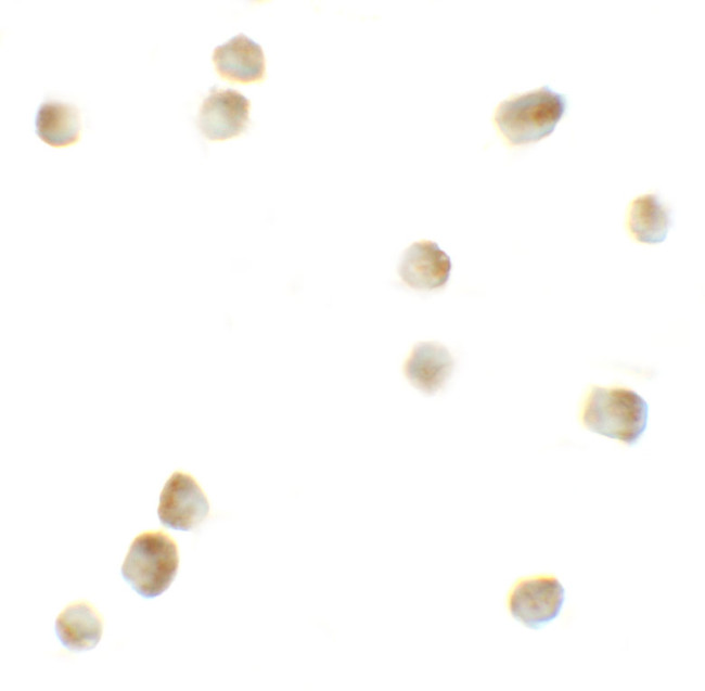 ROCK1 Antibody in Immunocytochemistry (ICC/IF)