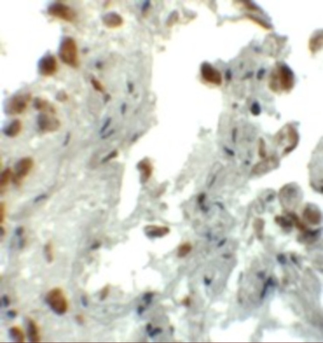 EZH1 Antibody in Immunohistochemistry (IHC)