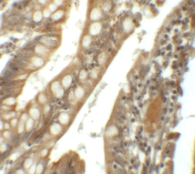 SIK1 Antibody in Immunohistochemistry (IHC)