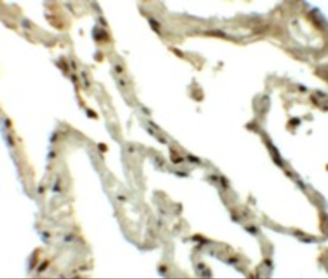 TSN Antibody in Immunohistochemistry (IHC)