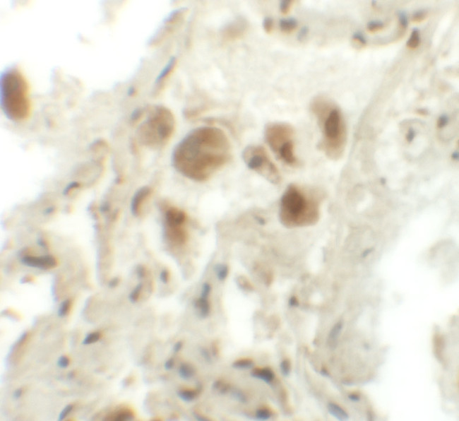 RASSF10 Antibody in Immunohistochemistry (IHC)