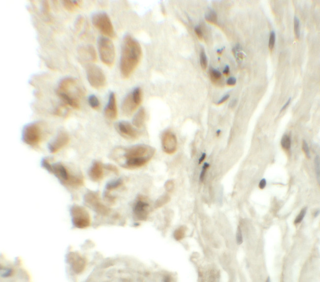 TYW1 Antibody in Immunohistochemistry (IHC)