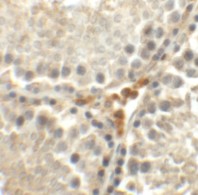 MEIG1 Antibody in Immunohistochemistry (IHC)
