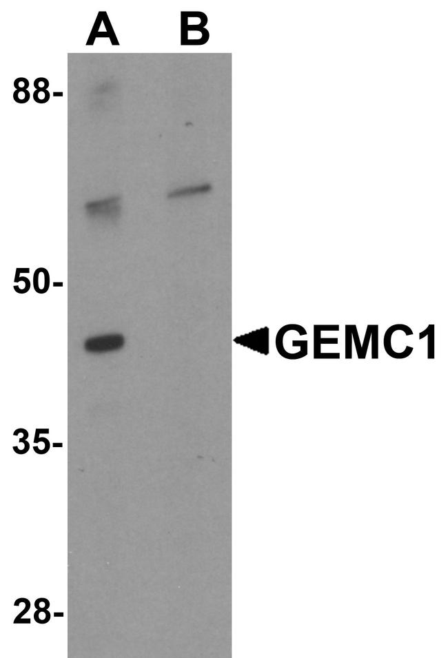 GEMC1 Antibody in Western Blot (WB)