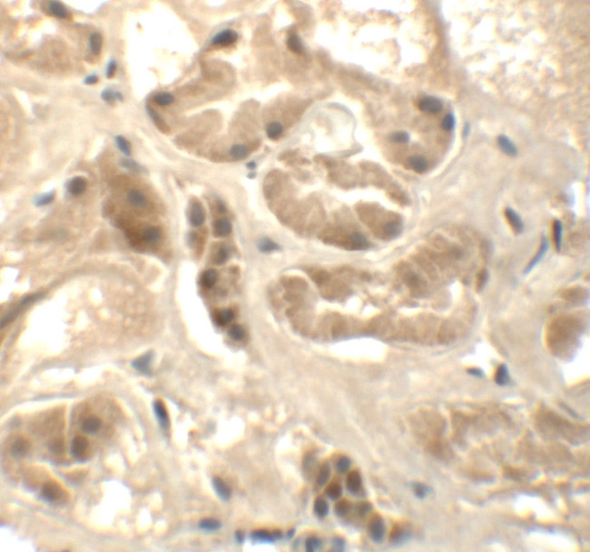 ATAD3B Antibody in Immunohistochemistry (IHC)