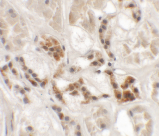 AP3S1 Antibody in Immunohistochemistry (IHC)
