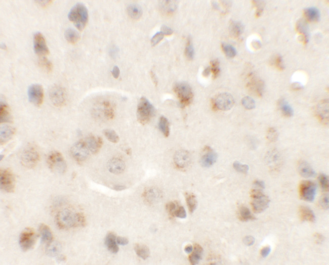 AP3M1 Antibody in Immunohistochemistry (IHC)