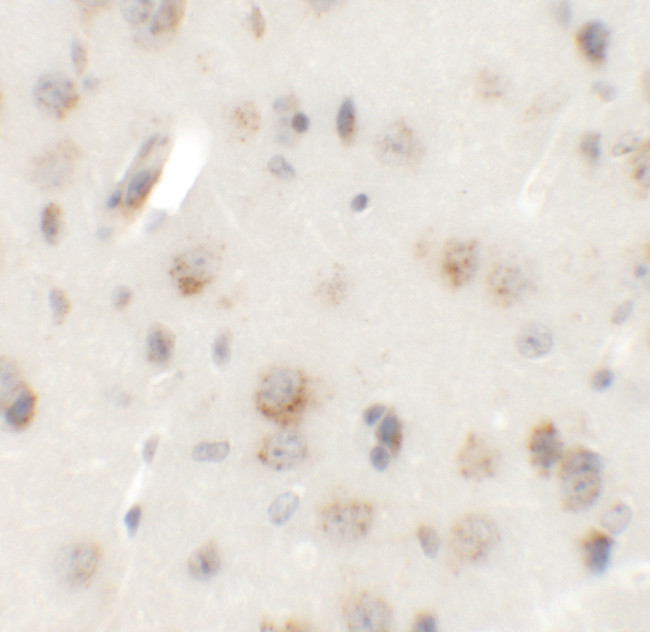 AP3B2 Antibody in Immunohistochemistry (IHC)