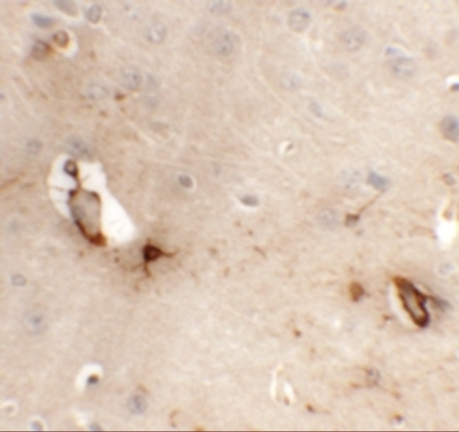TMEM204 Antibody in Immunohistochemistry (IHC)