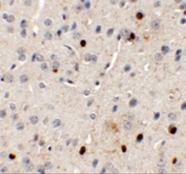 SPRYD3 Antibody in Immunohistochemistry (IHC)