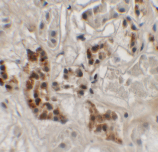 SPRYD4 Antibody in Immunohistochemistry (IHC)