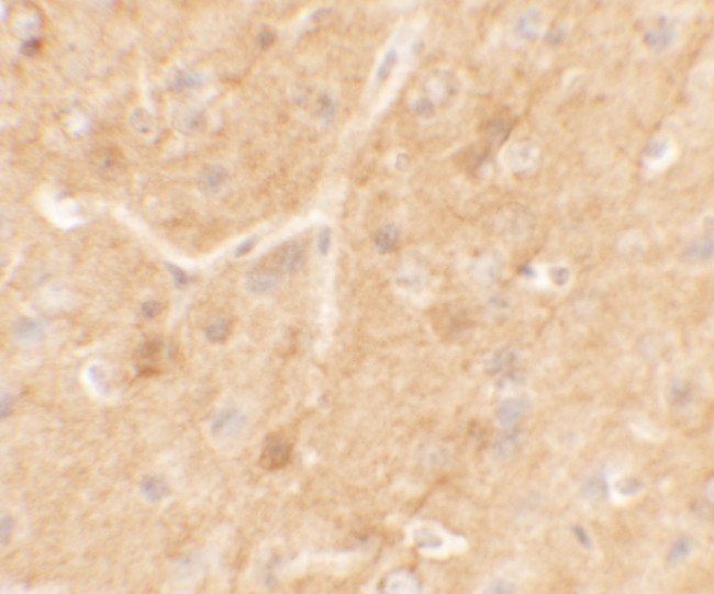 SPRYD5 Antibody in Immunohistochemistry (IHC)