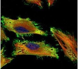 Acetylcholinesterase Antibody in Immunocytochemistry (ICC/IF)