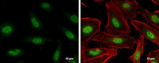 MUS81 Antibody in Immunocytochemistry (ICC/IF)