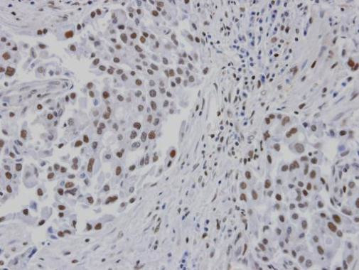 RPA14 Antibody in Immunohistochemistry (Paraffin) (IHC (P))