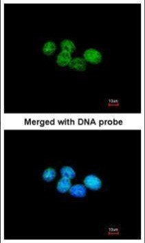 ERCC8 Antibody in Immunocytochemistry (ICC/IF)