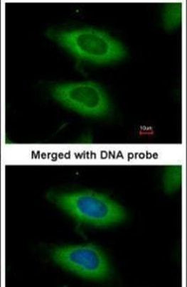 Caspase 4 Antibody in Immunocytochemistry (ICC/IF)