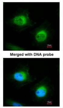 Cofilin 2 Antibody in Immunocytochemistry (ICC/IF)