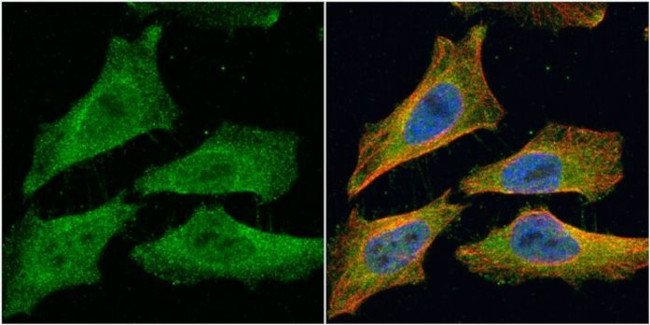 EML1 Antibody in Immunocytochemistry (ICC/IF)