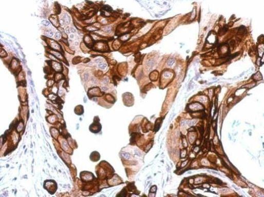 Apelin receptor Antibody in Immunohistochemistry (Paraffin) (IHC (P))