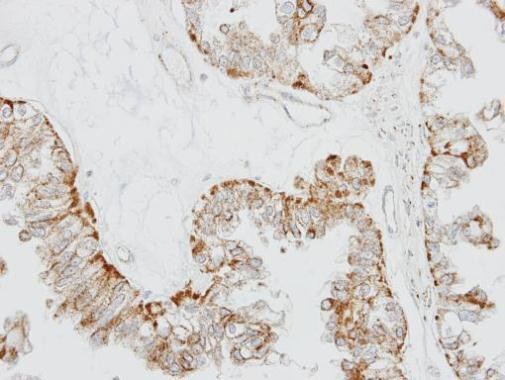 OR51E1 Antibody in Immunohistochemistry (Paraffin) (IHC (P))