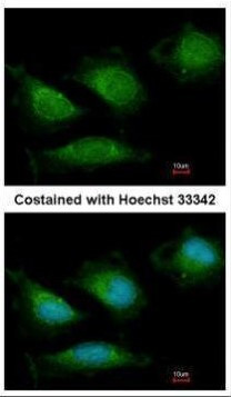 POLG Antibody in Immunocytochemistry (ICC/IF)