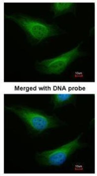 FANCC Antibody in Immunocytochemistry (ICC/IF)