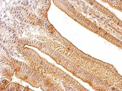 Tartrate Resistant Acid Phosphatase Antibody in Immunohistochemistry (Paraffin) (IHC (P))