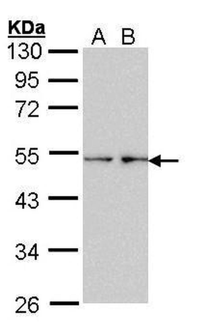 Fascin Antibody in Western Blot (WB)