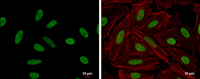 HMGA2 Antibody in Immunocytochemistry (ICC/IF)