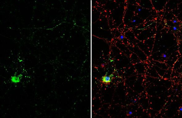 DKK3 Antibody in Immunocytochemistry (ICC/IF)