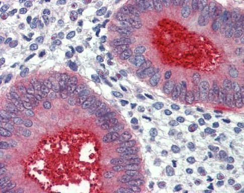 HPa2 Antibody in Immunohistochemistry (Paraffin) (IHC (P))