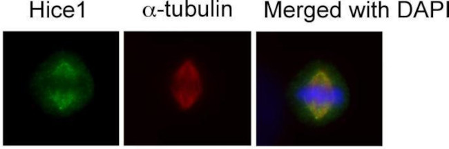 HICE1 Antibody in Immunocytochemistry (ICC/IF)