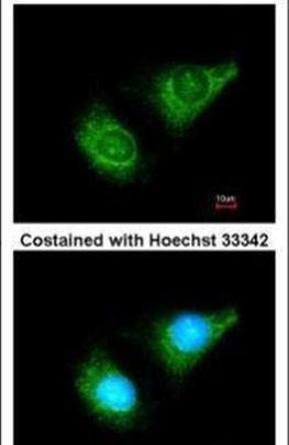 Caspase 8 Antibody in Immunocytochemistry (ICC/IF)