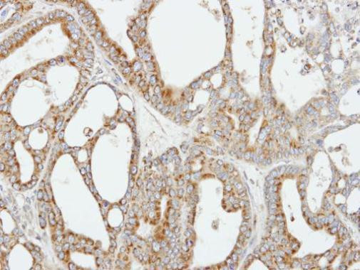 COX5B Antibody in Immunohistochemistry (Paraffin) (IHC (P))