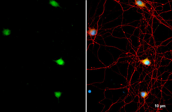 Acetylcholinesterase Antibody in Immunocytochemistry (ICC/IF)