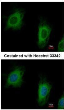 TTC1 Antibody in Immunocytochemistry (ICC/IF)
