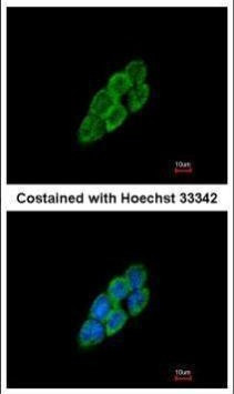 LTBP4 Antibody in Immunocytochemistry (ICC/IF)