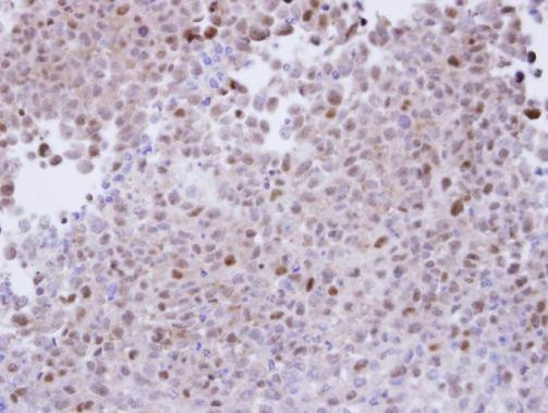 PSMA7 Antibody in Immunohistochemistry (Paraffin) (IHC (P))