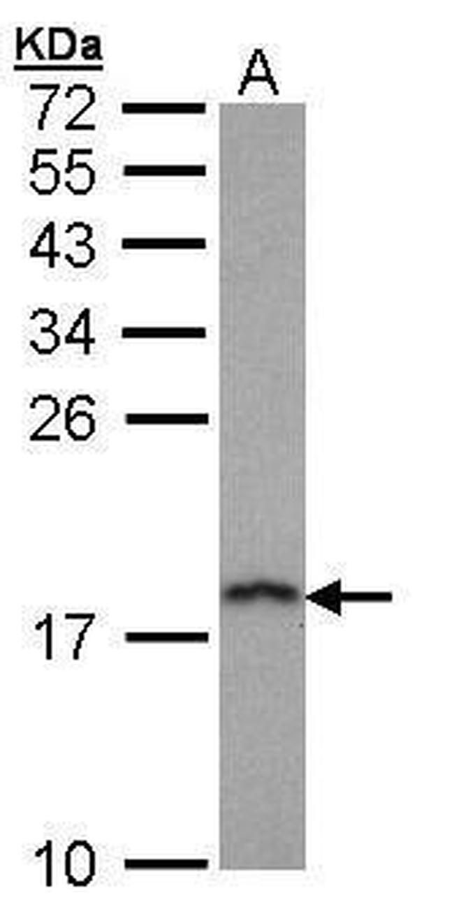 PFDN5 Antibody in Western Blot (WB)