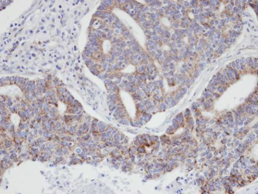 p21 ARC Antibody in Immunohistochemistry (Paraffin) (IHC (P))