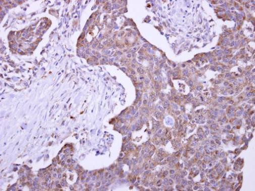 MLEC Antibody in Immunohistochemistry (Paraffin) (IHC (P))