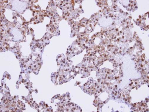 AKAP17A Antibody in Immunohistochemistry (Paraffin) (IHC (P))