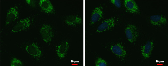 UQCRFS1 Antibody in Immunocytochemistry (ICC/IF)