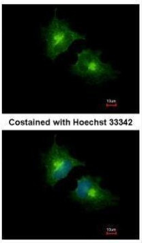 SCAMP3 Antibody in Immunocytochemistry (ICC/IF)